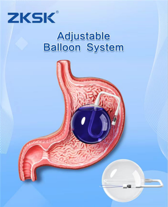 Ayarlanabilir İntragastrik Balon Kilo Kaybı Endoskopik Gastrik Balon